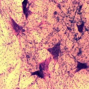 신경세포(뉴런)슬라이드