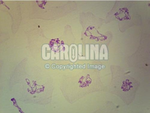 초파리 침샘염색체 슬라이드